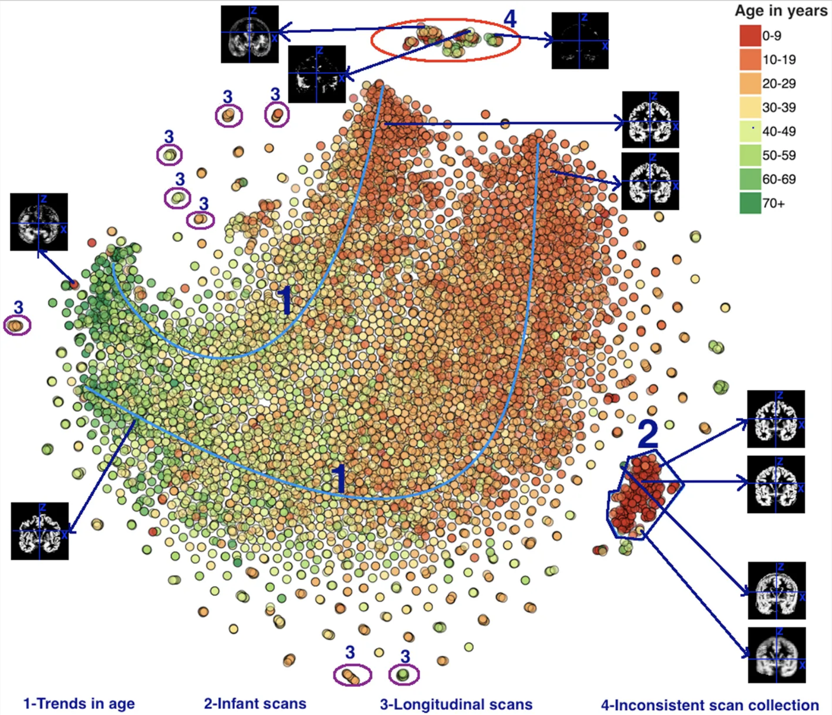 Brain Pattern Visualization Tool